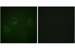 Immunofluorescence analysis of HeLa cells, using MARK1/2/3/4 (Ab-215) Antibody. (MARK1/2/3/4 anticorps  (AA 181-230))