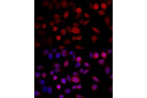 Immunofluorescence analysis of HeLa cells using CYP1B1 antibody (ABIN3021930, ABIN3021931, ABIN3021932 and ABIN6217881) at dilution of 1:100 (40x lens).