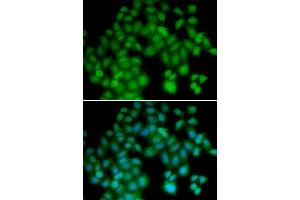 Immunofluorescence analysis of HeLa cells using TMSB4X antibody (ABIN3213357). (TMSB4X anticorps)