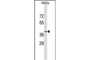 Western blot analysis in WiDr cell line lysates (35ug/lane). (DUOXA2 anticorps  (C-Term))