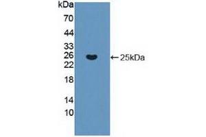 Detection of Recombinant KRAS, Human using Polyclonal Antibody to V-Ki-Ras2 Kirsten Rat Sarcoma Viral Oncogene Homolog (KRAS) (K-RAS anticorps  (AA 1-189))