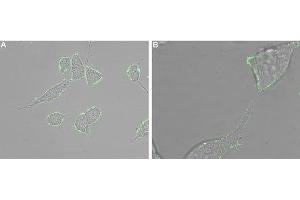 Expression of CXCR5 in human LNCaP cells - Cell surface detection of CXCR5 in intact living human prostate carcinoma (LNCaP) cells.