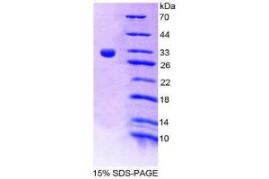 SDS-PAGE (SDS) image for Ribonuclease T2 (RNASET2) (AA 32-259) protein (His tag) (ABIN1080675) (RNASET2 Protein (AA 32-259) (His tag))