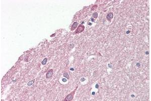 Image no. 2 for anti-Platelet-Activating Factor Acetylhydrolase 1b, Regulatory Subunit 1 (45kDa) (PAFAH1B1) (N-Term) antibody (ABIN6749762)