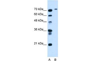 WB Suggested Anti-BCHE Antibody Titration:  1. (Butyrylcholinesterase anticorps  (N-Term))