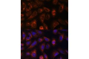 Immunofluorescence analysis of U-2 OS cells using CAD antibody (ABIN6130029, ABIN6137837, ABIN6137838 and ABIN6224367) at dilution of 1:100.