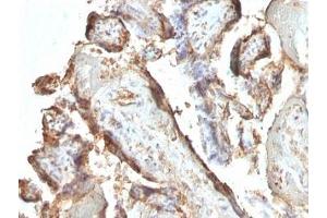 anti-hCG Holo antibody