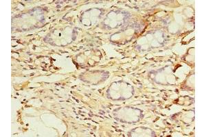 Immunohistochemistry of paraffin-embedded human small intestine tissue using ABIN7150796 at dilution of 1:100 (DYRK4 anticorps  (AA 201-520))