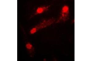 Immunofluorescent analysis of LIMK2 staining in COLO205 cells. (LIMK2 anticorps  (Center))
