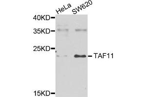 Western blot analysis of extracts of various cells, using TAF11 antibody. (TAF11 anticorps)
