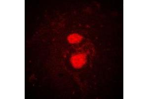 anti-Fyn-Related Kinase (FRK) (Center) antibody