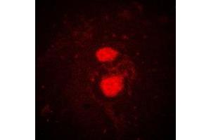 Immunofluorescent analysis of FRK staining in K562 cells. (FRK anticorps  (Center))