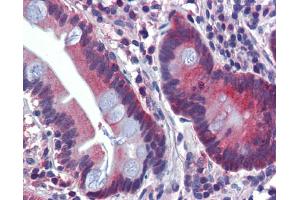 Immunohistochemistry (IHC) image for anti-ATPase, H+ Transporting, Lysosomal V0 Subunit A2 (ATP6V0A2) (N-Term) antibody (ABIN2775376)