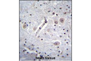 RK Antibody (C-term) (ABIN652301 and ABIN2841363) immunohistochemistry analysis in forlin fixed and paraffin embedded hun brain tissue followed by peroxidase conjugation of the secondary antibody and DAB staining.