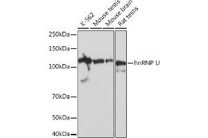 HNRNPU 抗体