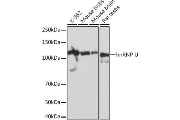 HNRNPU anticorps