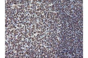 Image no. 13 for anti-F-Box Protein 21 (FBXO21) antibody (ABIN1498233) (FBXO21 anticorps)