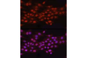 Immunofluorescence analysis of PC-12 cells using N6 Rabbit pAb (ABIN6131779, ABIN6144314, ABIN6144315 and ABIN6223027) at dilution of 1:100 (40x lens). (N6AMT1 anticorps  (AA 1-186))