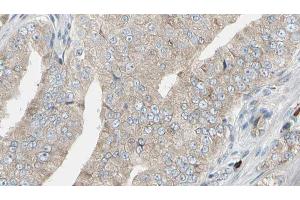 ABIN6272945 at 1/100 staining Human prostate tissue by IHC-P. (LDHB anticorps  (N-Term))
