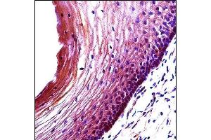 BBC3 Antibody (Center) (ABIN658021 and ABIN2850502) immunohistochemistry analysis in formalin fixed and paraffin embedded human cervix tissue followed by peroxidase conjugation of the secondary antibody and DAB staining.