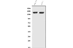 Western blot analysis of Factor H/Cfh using anti-Factor H/Cfh antibody (ABIN7599985).