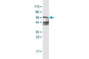 Western Blot detection against Immunogen (61. (ZNF187 anticorps  (AA 1-325))