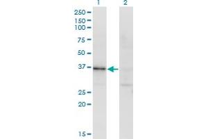 Western Blot analysis of RBKS expression in transfected 293T cell line by RBKS monoclonal antibody (M01), clone 3B4. (Ribokinase anticorps  (AA 1-322))