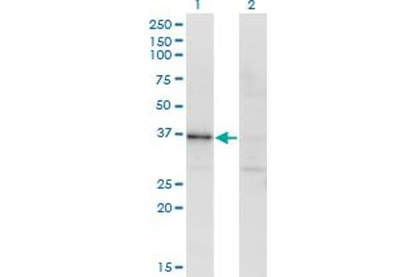 Ribokinase anticorps  (AA 1-322)