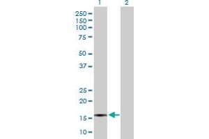 Western Blot analysis of CXCL5 expression in transfected 293T cell line by CXCL5 MaxPab polyclonal antibody. (CXCL5 anticorps  (AA 1-114))