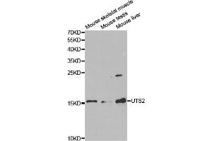 Western blot analysis of extracts of various cell lines, using UTS2 antibody. (Urotensin 2 anticorps)