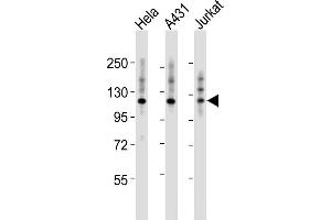 All lanes : Anti-ITGA7 Antibody (N-term) at 1:2000 dilution Lane 1: Hela whole cell lysates Lane 2: A431 whole cell lysates Lane 3: Jurkat whole cell lysates Lysates/proteins at 20 μg per lane. (ITGA7 anticorps  (N-Term))