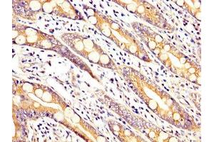 anti-rho GTPase Activating Protein 18 (ARHGAP18) (AA 389-577) antibody