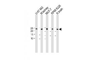 All lanes : Anti-C9orf95 Antibody (N-term) at 1:1000 dilution Lane 1: U-87 MG whole cell lysate Lane 2: M. (NMRK1 anticorps  (N-Term))