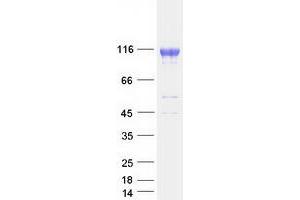 Validation with Western Blot