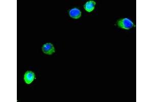 Immunofluorescent analysis of Hela cells using ABIN7151266 at dilution of 1:100 and Alexa Fluor 488-congugated AffiniPure Goat Anti-Rabbit IgG(H+L) (TRIM37 anticorps  (AA 301-600))