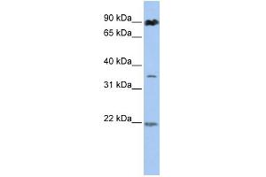 WB Suggested Anti-C13orf7 Antibody Titration:  0. (RNF219 anticorps  (N-Term))