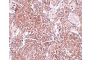 Immunohistochemistry of TSPAN9 in human spleen tissue with this product at 2.