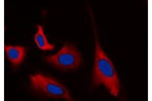 Immunofluorescent analysis of CDK5 (pY15) staining in HEK293T cells.