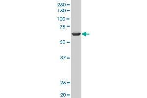 AATF polyclonal antibody (A01), Lot # AUH0060323QCS1 Western Blot analysis of AATF expression in PC-12 .