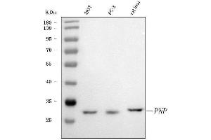 Western blot analysis of PNP using anti-PNP antibody (ABIN4886701). (PNP anticorps  (Middle Region))