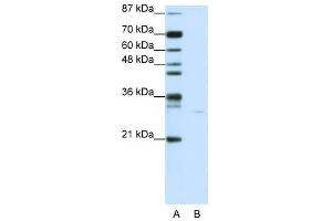 SGK1 antibody used at 1 ug/ml to detect target protein. (SGK1 anticorps  (N-Term))