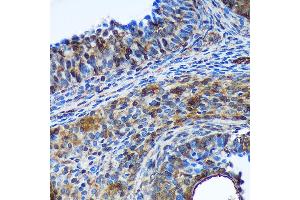 Immunohistochemistry of paraffin-embedded Rat ovary using TSN Rabbit pAb  at dilution of 1:100 (40x lens).