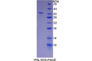 SDS-PAGE analysis of Rat FSTL1 Protein. (FSTL1 Protéine)