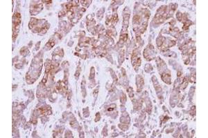 Image no. 2 for anti-Calpastatin (CAST) (AA 275-700) antibody (ABIN1497106)