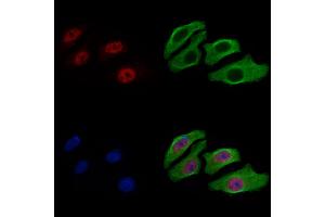 ABIN7093308 and ABIN7097327 staining Hela cells by IF/ICC. (CHEK2 anticorps  (C-Term))
