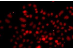 Immunofluorescence analysis of A549 cells using RRAGC Polyclonal Antibody (GTR2 anticorps)