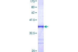 Image no. 1 for Fragile X Mental Retardation, Autosomal Homolog 1 (FXR1) (AA 121-220) protein (GST tag) (ABIN1354555)
