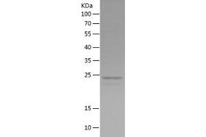 Western Blotting (WB) image for Paired Box 8 (PAX8) (AA 243-450) protein (His tag) (ABIN7124298)