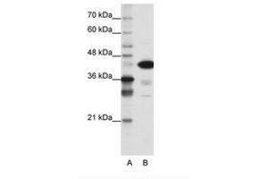 Image no. 1 for anti-TAR DNA Binding Protein (TARDBP) (N-Term) antibody (ABIN202468)