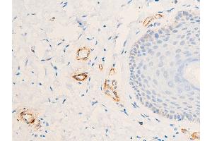 ABIN6267068 at 1/100 staining human skin tissue sections by IHC-P.